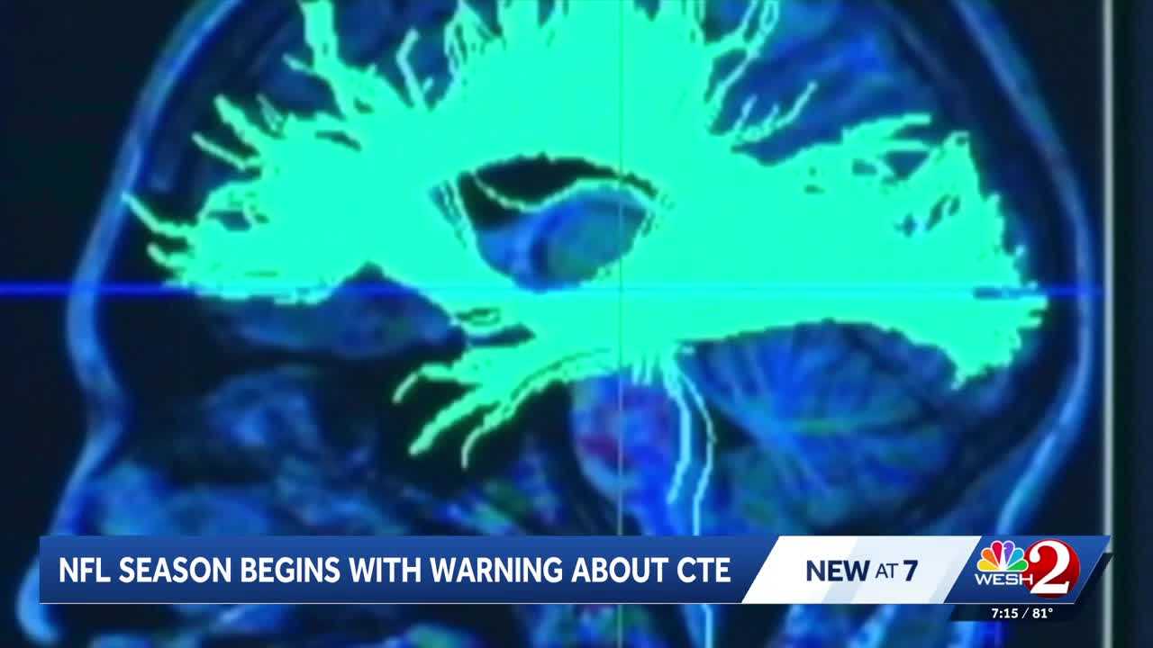 Former NFL player and neurosurgeon addresses CTE concerns and youth football safety — WESH 2 Orlando, Winter Park Sports news
